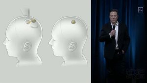 Neuralink-brain-implant-prototype-NoypiGeeks