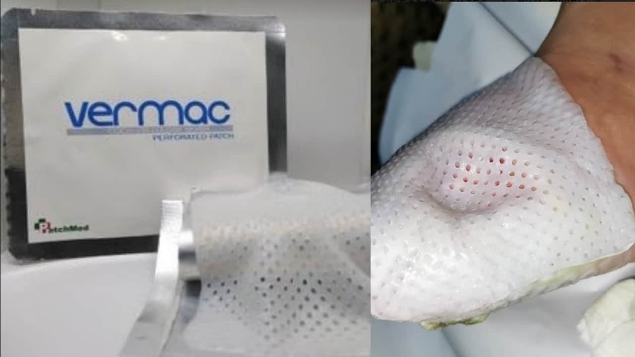 Coco-patch-diabetics-Vermac