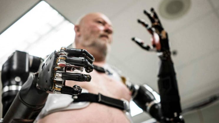 Artificial-Human-Arm-2023