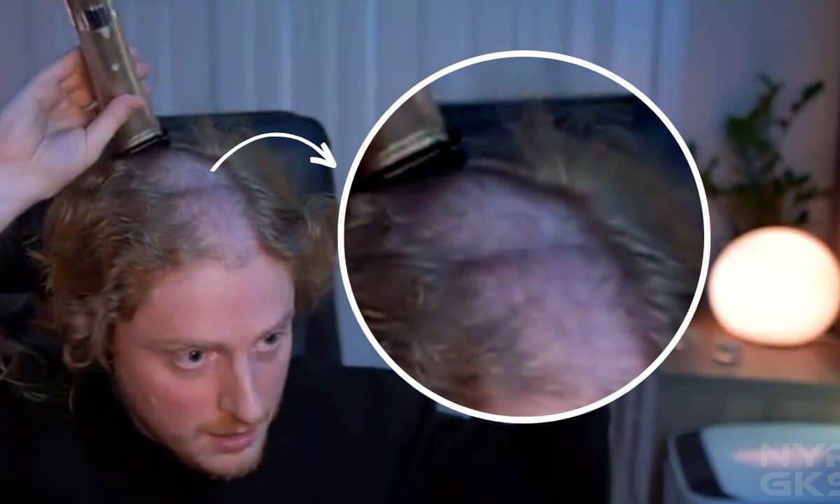 Headphones-Gamers-Head-Dent