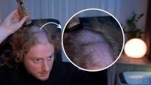 Headphones-Gamers-Head-Dent