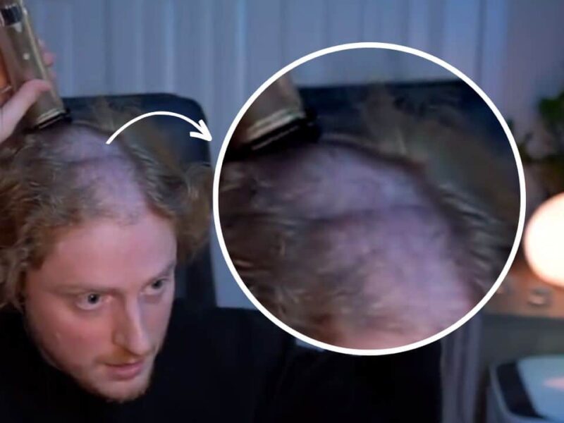 Headphones-Gamers-Head-Dent