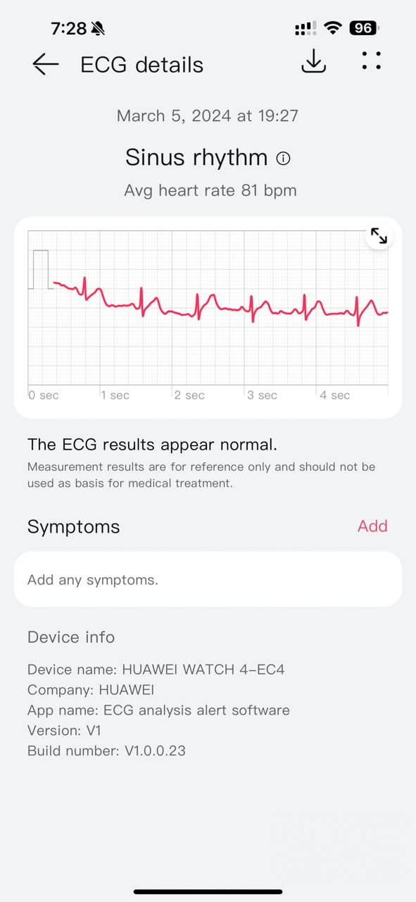 HUAWEI-Watch-4-ECG-Reading
