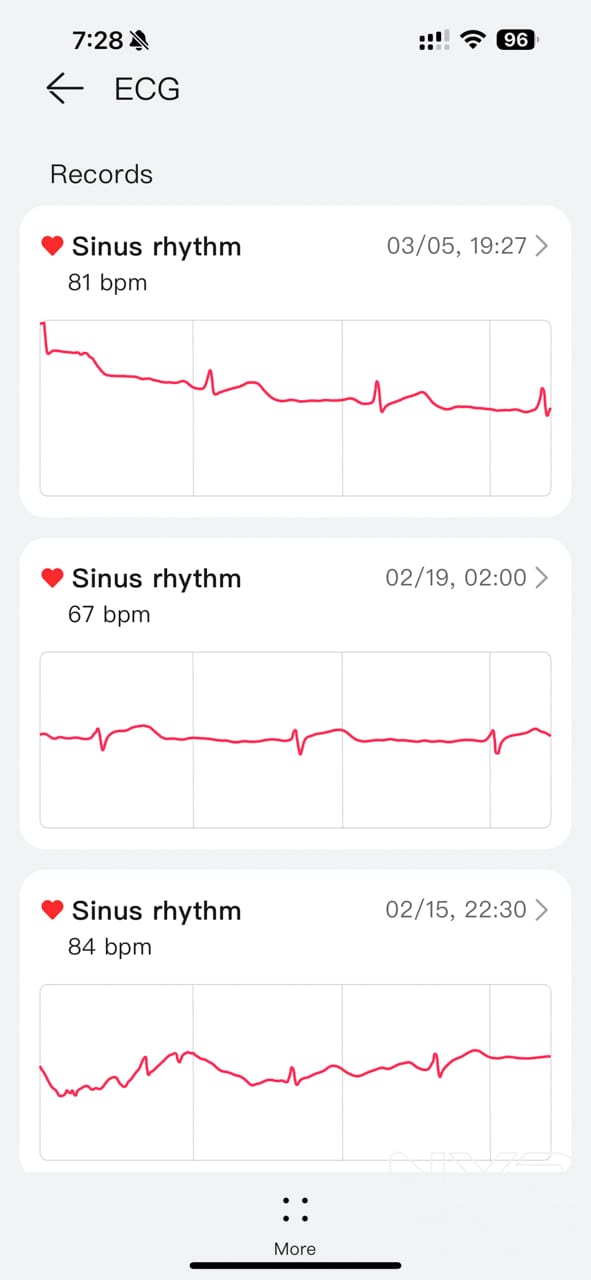 HUAWEI-Watch-4-ECG