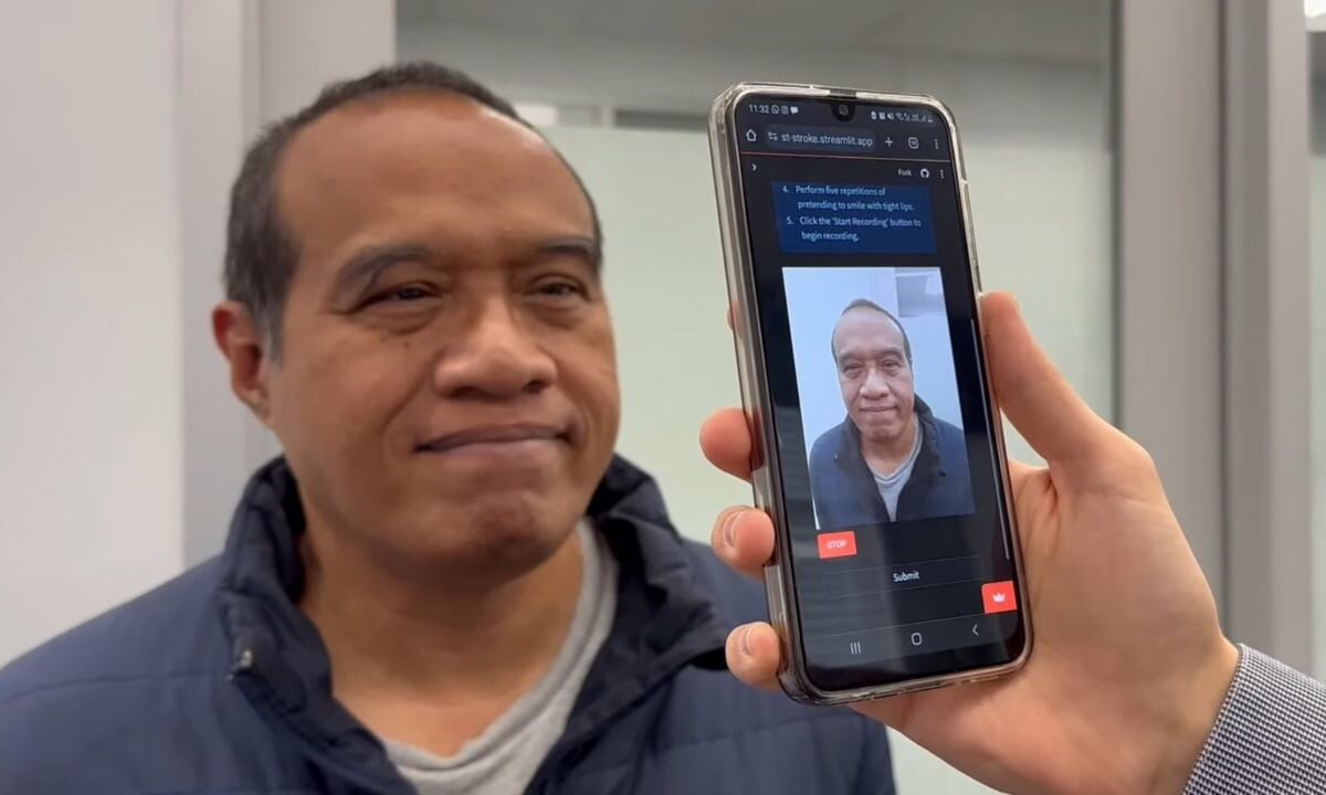 AI-smartphone-app-detect-strokes