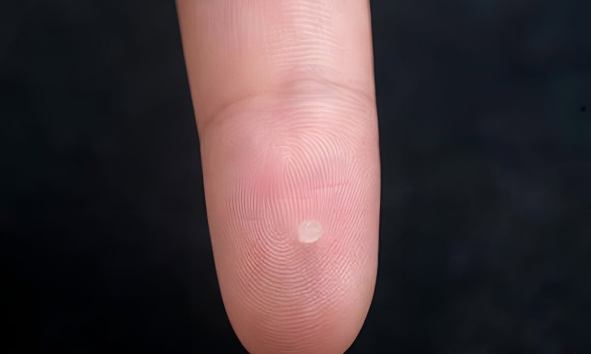 Gel-Sensor-Detect-Trauma-Brain-Injury