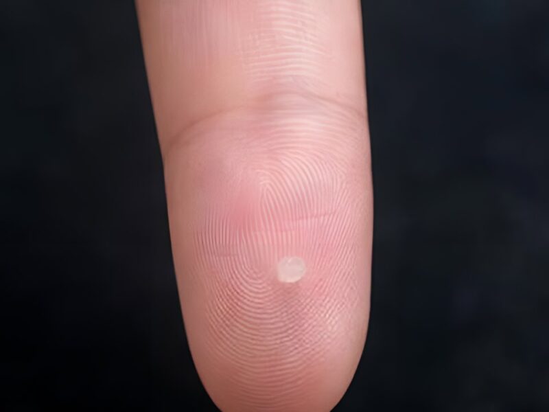 Gel-Sensor-Detect-Trauma-Brain-Injury