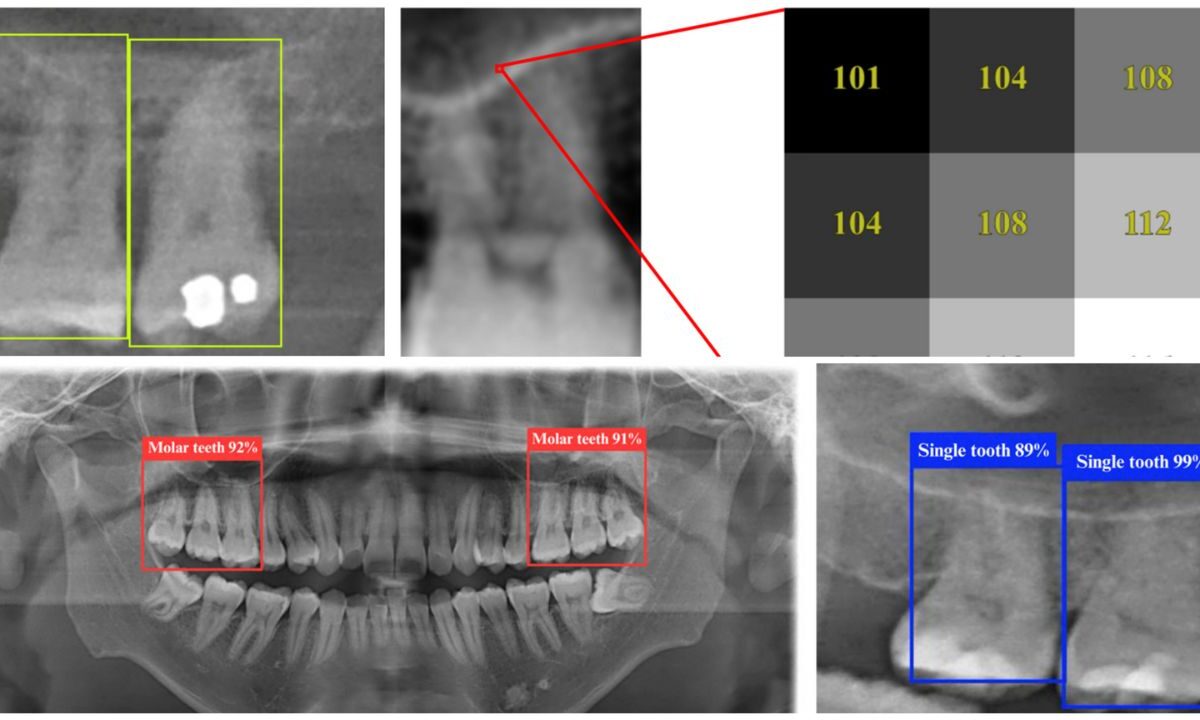 Ateneo-researchers-AI-Dental-assistant