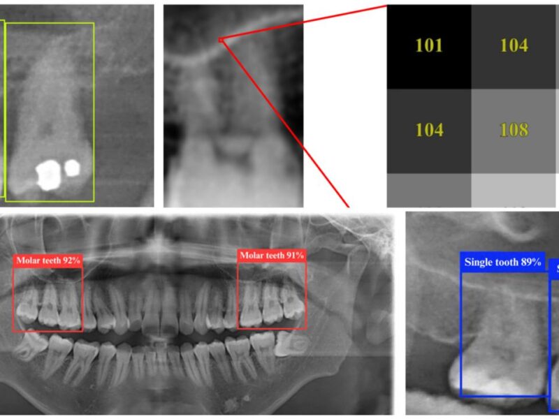 Ateneo-researchers-AI-Dental-assistant